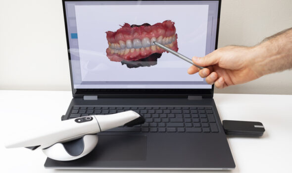 Dentist Shows 3D Scanned Picture of Scanned Teeth on Monitor of Computer, White 3d Intraoral Dental Tooth Scanner Lying on Table. Dental Equipment, Device For Scanning Teeth. Dentistry. Horizontal