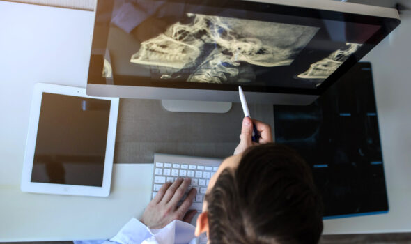 top view of a male radiologist examining neck x-rays (cervical vertebrae) on computer