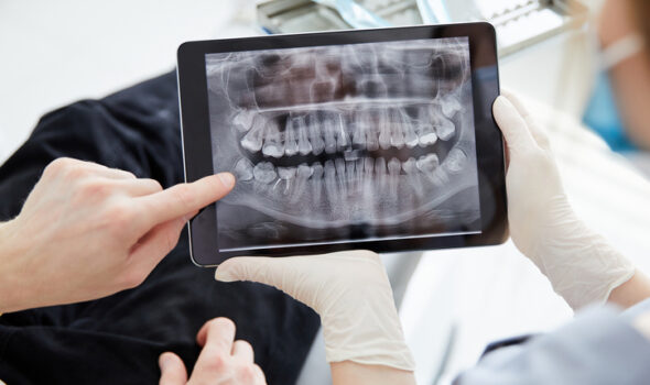 Close up woman dentist holding patient mouth digital film.Female doctor showing patient oral scan